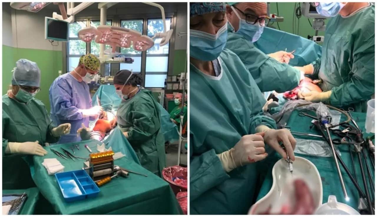 Operacja zmniejszenia żołądka nfz gdzie - sprawdź najlepsze ośrodki w Polsce