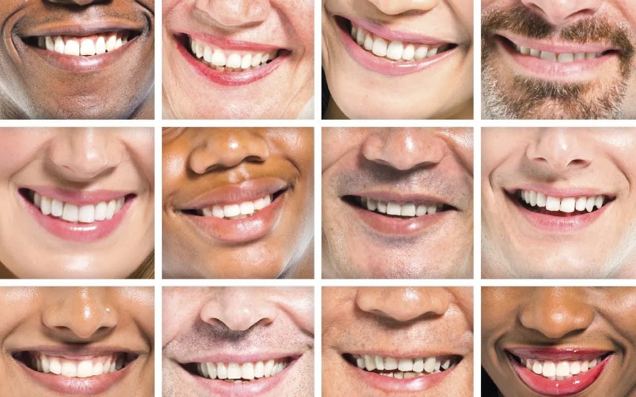 Czy usuwanie kamienia jest na NFZ? Sprawdź warunki i częstotliwość