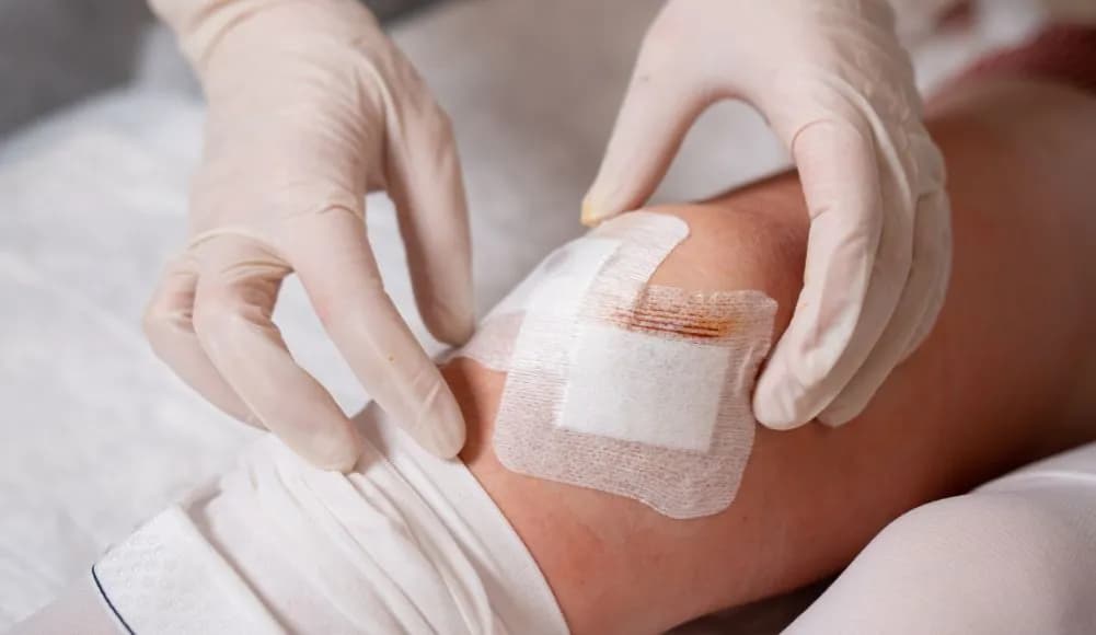 Ile trwa rehabilitacja po artroskopii kolana? Poznaj kluczowe informacje