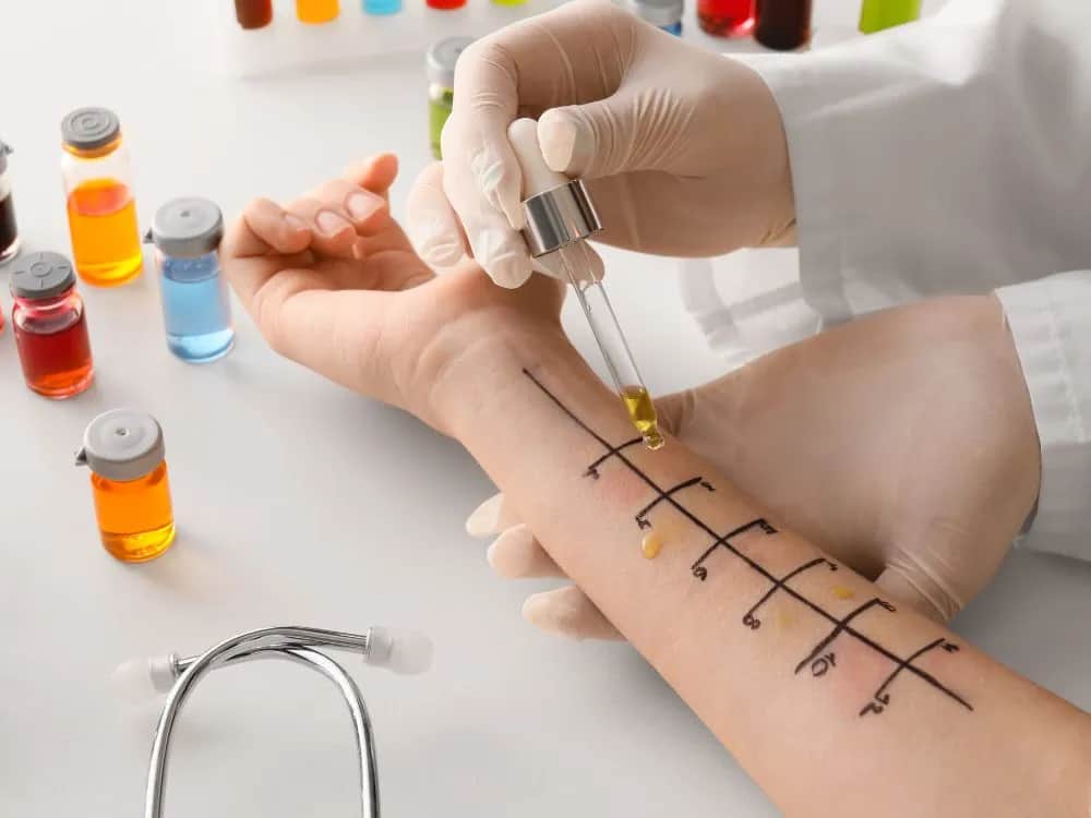 Czy testy alergiczne są na NFZ? Sprawdź, co musisz wiedzieć