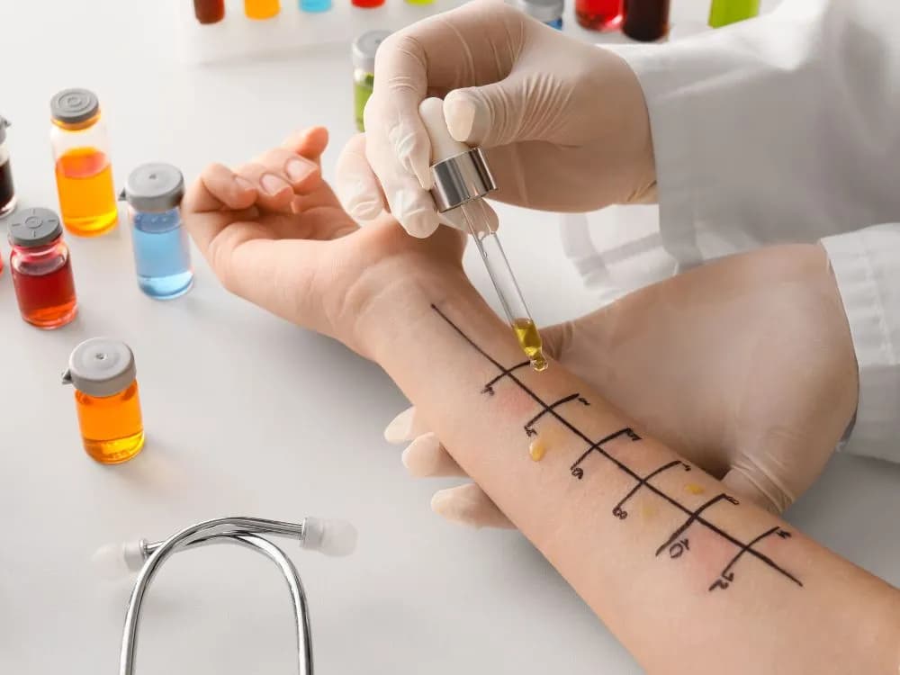 Czy testy alergiczne są na NFZ? Sprawdź, co musisz wiedzieć