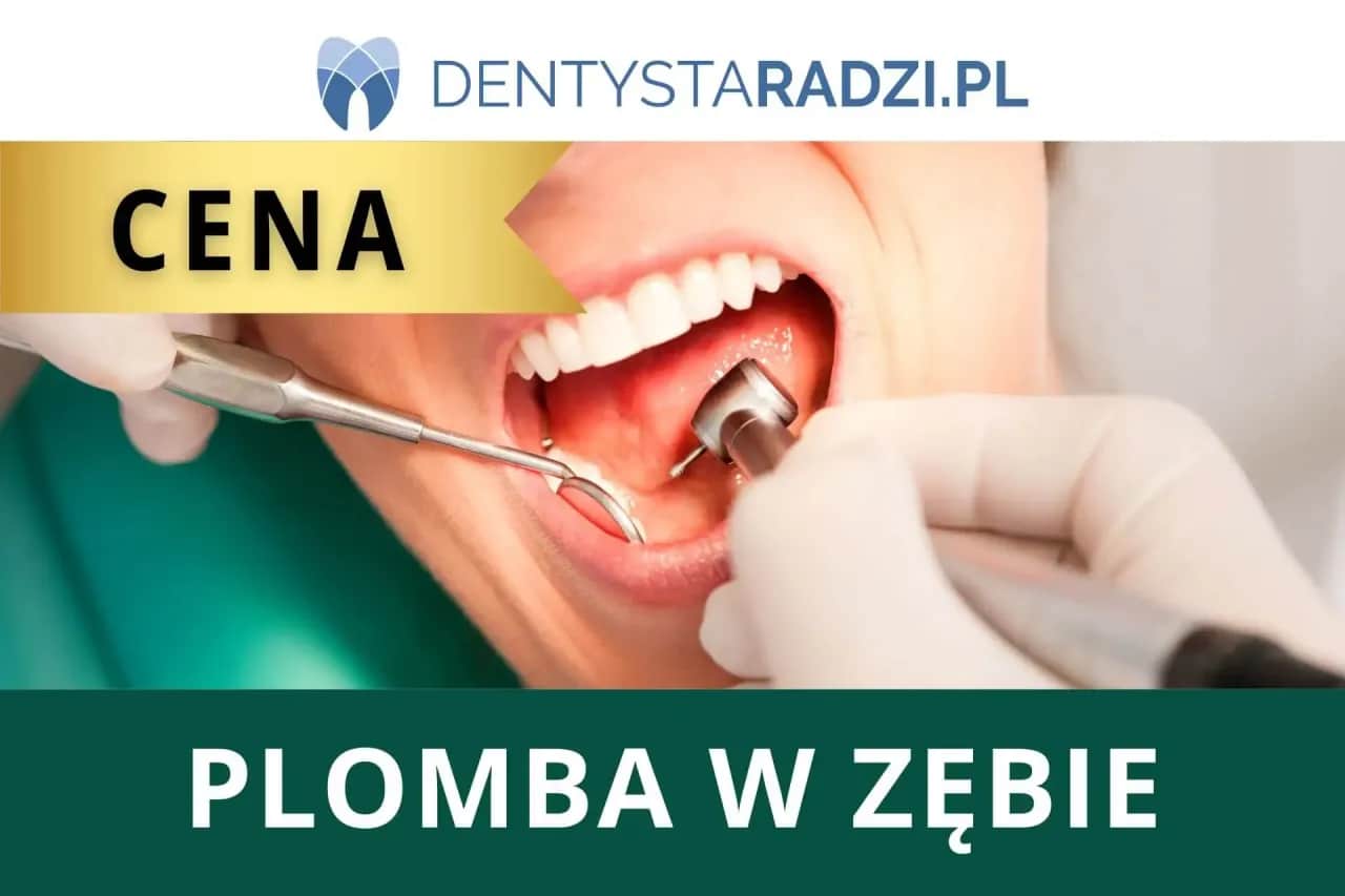 Ile kosztuje plomba światłoutwardzalna na nfz? Sprawdź, kto może skorzystać