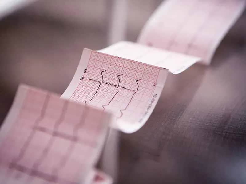 Prawidłowy puls u dzieci – co musisz wiedzieć, aby dbać o zdrowie