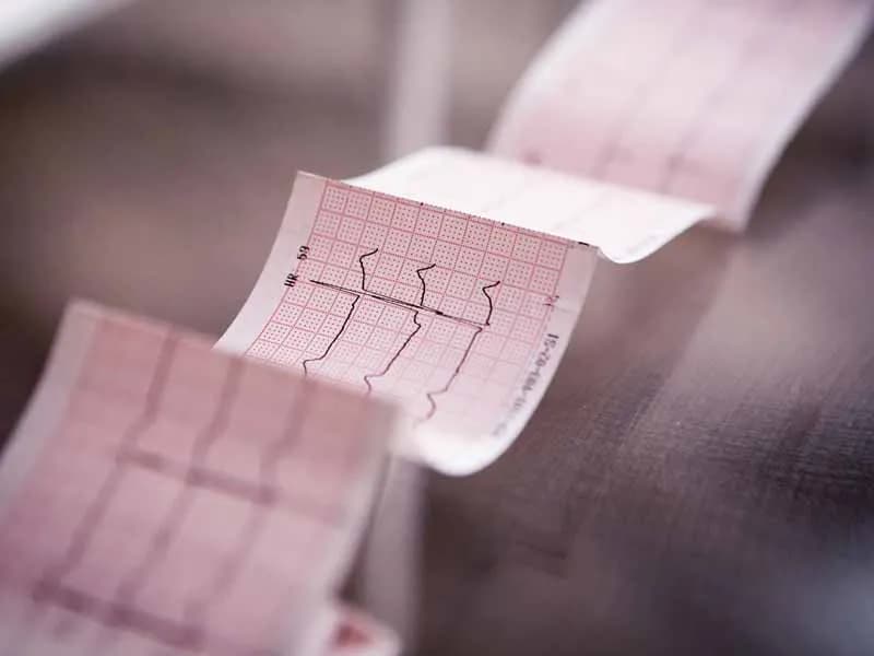 Prawidłowy puls u dzieci – co musisz wiedzieć, aby dbać o zdrowie