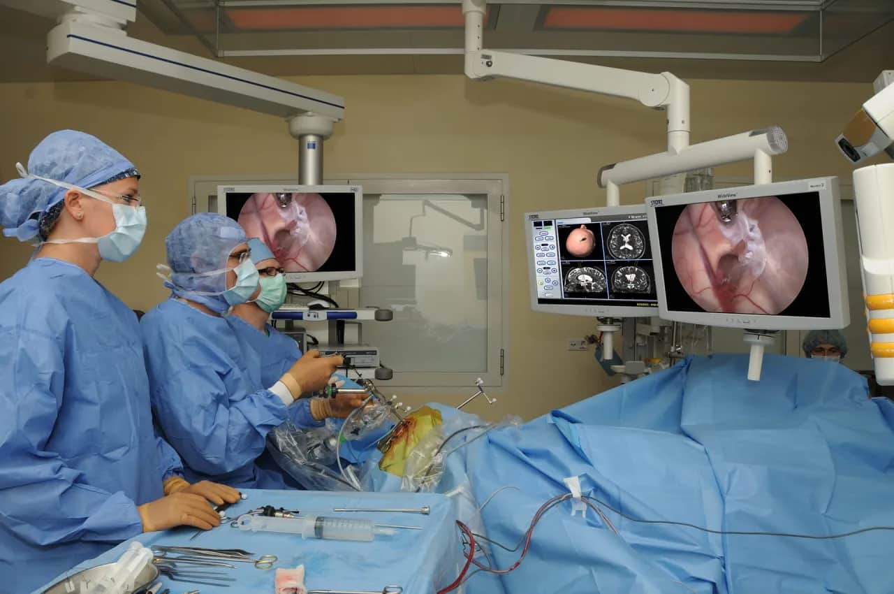 Ile trwa rehabilitacja po operacji guza mózgu? Odkryj kluczowe informacje