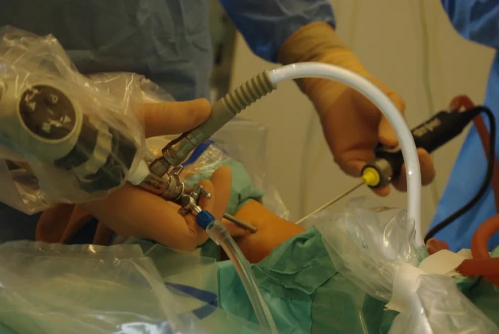 Ile trwa rehabilitacja po artroskopii stawu skokowego? Poznaj prawdę.