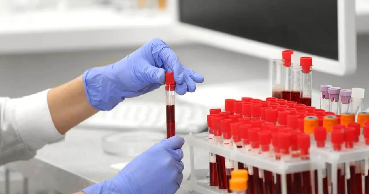 Jakie badania krwi na nfz są dostępne bezpłatnie i co warto wiedzieć