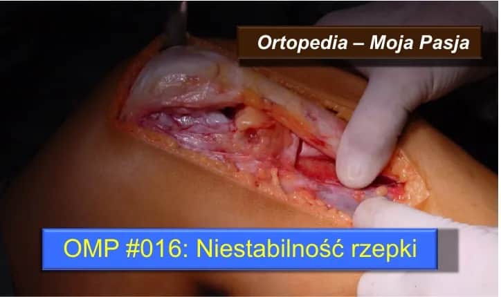 Ile trwa rehabilitacja po zwichnięciu rzepki? Sprawdź, co musisz wiedzieć