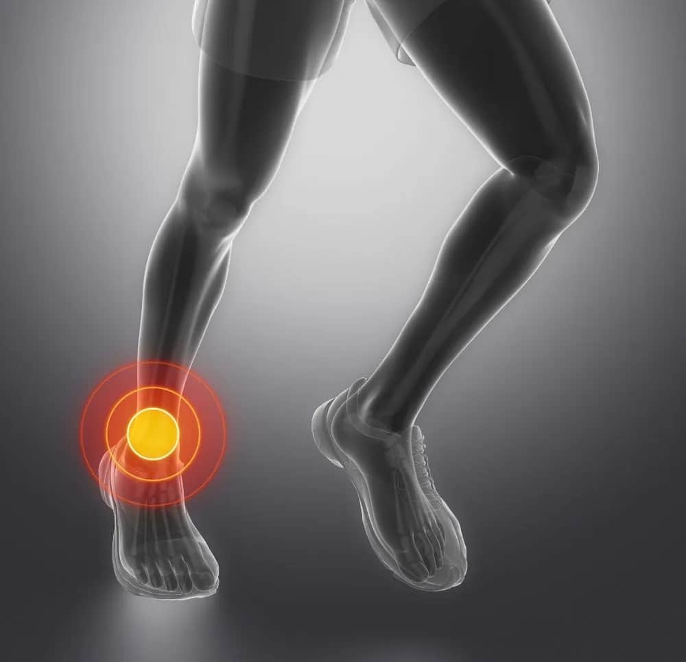 Rehabilitacja stawu skokowego: ile trwa powrót do sprawności?