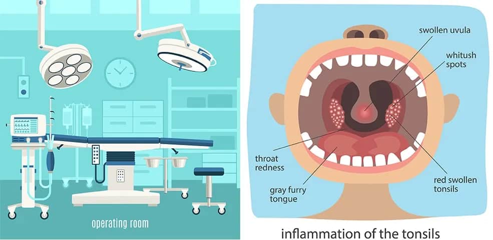 Gdzie najszybciej wyciąć migdałki nfz? Sprawdź najlepsze opcje w Polsce