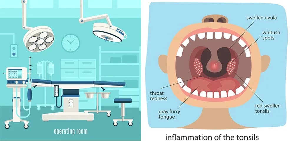 Gdzie najszybciej wyciąć migdałki nfz? Sprawdź najlepsze opcje w Polsce