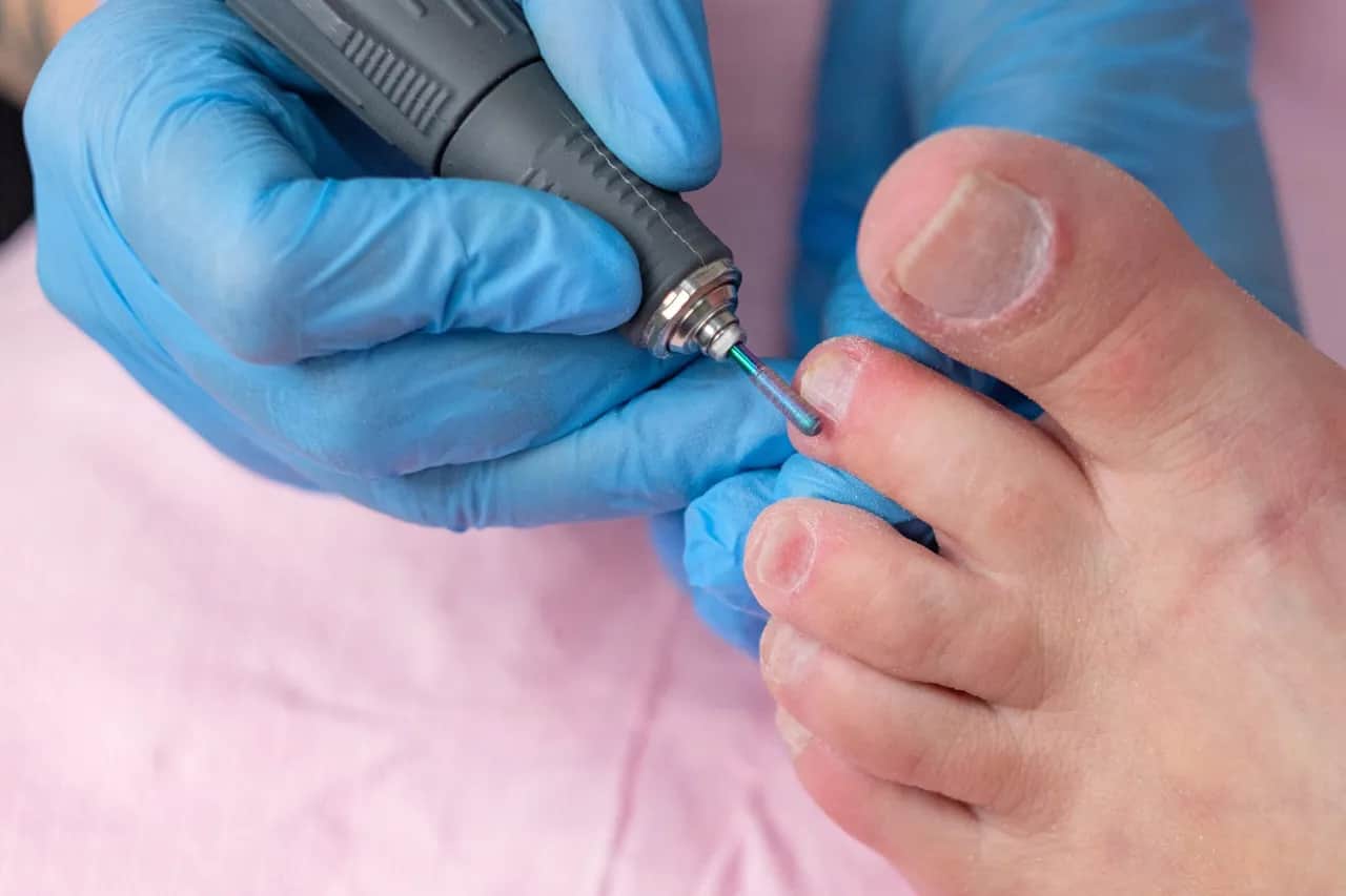 Czy podolog jest na NFZ? Dowiedz się, dlaczego musisz płacić samodzielnie