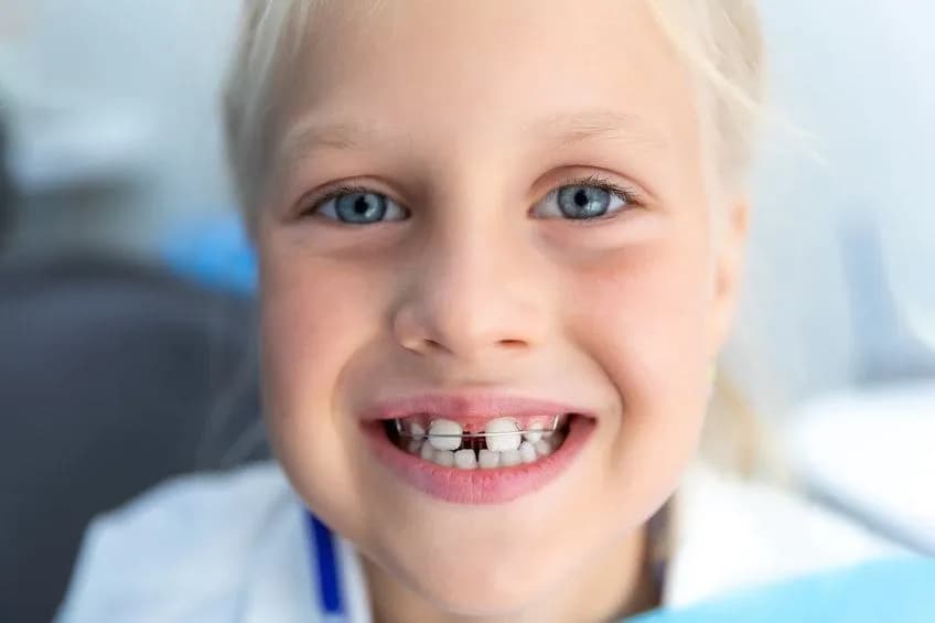 Czy ortodonta jest na NFZ? Ograniczenia i dostępność leczenia ortodontycznego